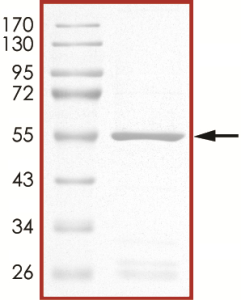 JAK3 (JH2 domain) Protein